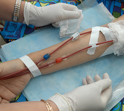 Close up of a patient's arm, receiving blood.