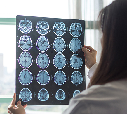 A medical scientist examining a brain scan.